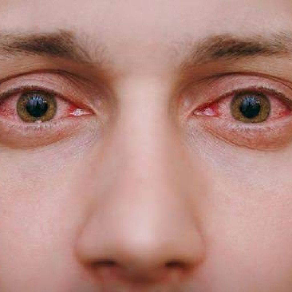 images - 2023-05-03T152445.174